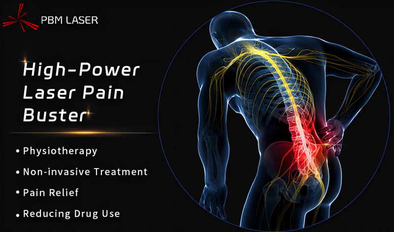 PBM Medikal Lazer 丨 Rehabilitasyon Kodunun Kilidini Açan Yüksek Güçlü Lazer, Çin'in Kronik Bel Ağrısı Teşhis ve Tedavi Kılavuzlarında (2024 Sürümü) A Sınıfı Öneri Aldı